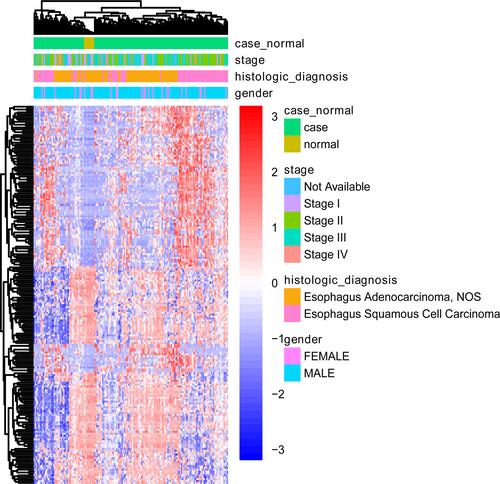 Figure 2 Heat map of the top 200 differentially methylated sites in terms of tumor stage, histologic diagnosis and sex. The figure shows the two-way hierarchical clustering results of the top 200 differentially methylated sites and samples. The clustering is constructed using the full chain method together with the Euclidean distance. Each row and column represents a differentially methylated sites and a sample, respectively. Differentially methylated sites clustering tree is shown on the right. Red indicates below the reference channel. Blue indicates the above reference.
