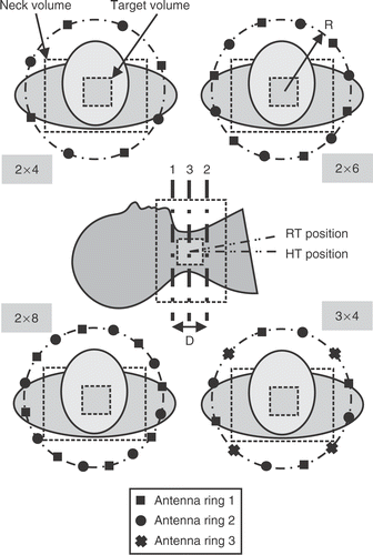 Figure 2. Multiple antenna ring arrangements and a schematic sagittal view in HT position.