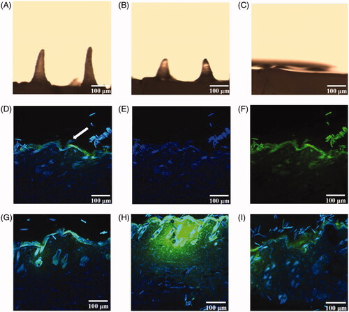 Figure 6. (A–C) MN morphology after administration for 1, 2, and 4 h. (D–F) Longitudinal sections of rat abdominal skin 1 h after administration with DAPI (D), SIN fluorescent labels (E), DAPI and SIN fluorescent labels (F). (G–I) Lengthwise section of rat abdominal skin after administration with DAPI and SIN fluorescent labels for 2, 4, and 8 h.