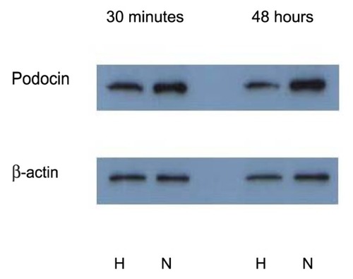 Figure 4B Western blot shows podocin expression reduced under hypoxia treatment, both after 30 minutes and 48 hours.