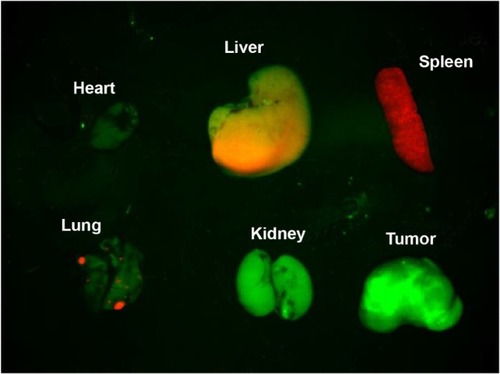 Figure 5 Luminescent images of major organs and tumor from Panc-1 tumor-bearing mouse injected with NIR QDs.Notes: The autofluorescence from organs is coded green, and the unmixed QD signal is coded red. Prominent uptake in the liver and spleen was visible.Abbreviations: NIR, near-infrared; QDs, quantum dots.