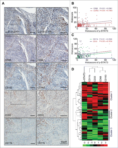 Figure 1. Correlation of phosphorylated STAT3 with MDSC and TAM markers in human head neck squamous cell carcinoma. (A) Representative immunohistochemical staining of p-STAT3Tyr705, CD68, CD163, CD33 and CD11b in HNSCC tissue. Scale bar, 50 μm. (B, C) The expression of p-STAT3Tyr705 was significantly correlated with CD68 (p < 0.01, r = 0.2561), CD163 (p < 0.05, r = 0.1903), CD11b (p < 0.01, r = 0.2500) and CD33 (p < 0.05, r = 0.1914) in human HNSCC by analyzing the tissue microarray immunohistochemical staining. Statistical analysis including normal mucosa (n = 32) and head neck squamous cell carcinoma (HNSCC, n = 86). (D) Hierarchical clustering reveals close relation of p-STAT3Tyr705, CD68, CD163, CD11b and CD33 in human HNSCC, mucosa (n = 32, Cluster 3), dysplasia (n = 12, cluster 2) and HNSCC (n = 86, cluster 1).