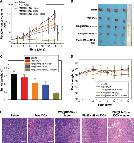 Figure 7 In vivo antitumor effect of MDA-MB-231 tumor bearing nude mice after intravenous injection of saline, free DOX, PM@HMSNs + laser, PDA@HMSNs-DOX + laser, PM@HMSNs-DOX with or without laser irradiation at an equivalent dose of DOX (7.5 mg/kg).Notes: (A) Relative tumor volume after different treatments. (B) Representative photographs of the tumors collected from varying groups of mice at the end of the treatments (day 14). (C) The tumor weights at the end of therapy on day 14. (D) The body weight of mice during treatment. (E) Representative H&E staining in histologic images from the tumor tissues. **P<0.01 and ***P<0.001. Scale bar: 50 µm.Abbreviations: PM, polydopamine-coated MoSe2; HMSNs, hollow mesoporous silica nanoparticles; DOX, doxorubicin; PDA, polydopamine.