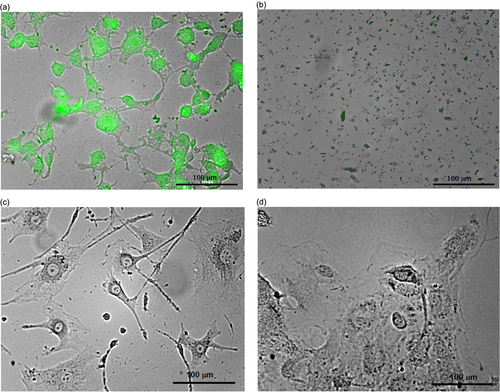 Figure 5. 3T3-L1 cells labeled with CFO NPs (1 mg ml−1) before (a) and after (b) ultrasound treatment. Non-labeled 3T3-L1 cells before (c) and after (d) ultrasound treatment are shown for comparison.