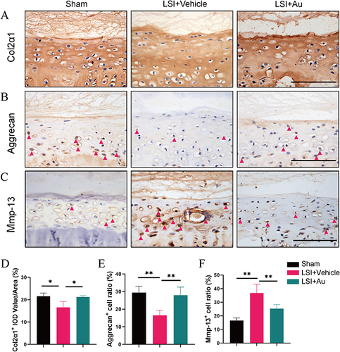 Figure 4 The effect of CGA on LSI-induced anabolism and catabolism in cartilage endplate. (A) The representative images of immumohistochemical staining and quantifications of Col2α1 in the caudal L4-5 endplate at 4 weeks. (B) The representative immumohistochemical images for Aggrecan and the ratio of positive cells in the whole caudal L4-5 endplate at 4 weeks. Red arrows indicated positive cells. Scale bar = 100 μm. (C) Immunostaining images and quantificational evaluation of Mmp-13 expression in caudal L4-5 endplate at 4 weeks post operation. Red arrows indicated positive cells. Scale bar = 100 μm. (D–F) Quantitative analyses of the rate of positive cells and average IOD value. The dose of Au was 10 mg/kg/day. Data were presented as means ± S.D. *p < 0.05; **p < 0.01; n ≥ 3 in each group.