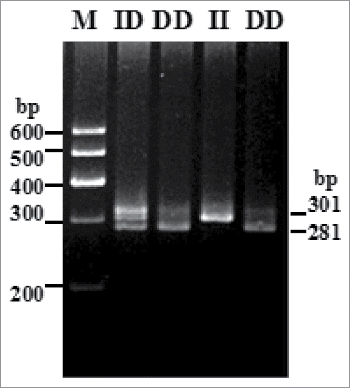 FIGURE 1. Electrophoresis pattern of the novel indel variants of sheep PRND gene.