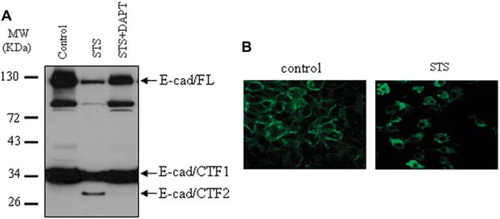 Figure 4. Treatment with staurosporine (STS) induced the translocation of E-cadherin in A431 cells. (A) A431 cells were treated with STS for 6 hours, lysed in RIPA and blotted with anti-E-cadherin antibody (C36). (B) STS-treated cells were fixed in 4% paraformaldehyde and stained with anti-cytoplasmic E-cadherin antibody (C36).