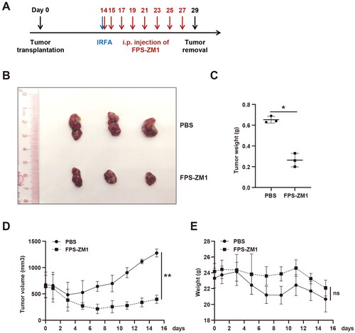 Figure 6. FPS-ZM1 treatment after IRFA inhibited the progression of residual cancer. (A) Design of animal experiments. The blue arrow indicates IRFA, and the red arrows represent the time of FPS-ZM1 treatments. (B) Representative tumor image of the PBS and FPS-ZM1 groups, n = 3. (C). Tumor weight of the PBS and FPS-ZM1 group, n = 3. (D). Tumor growth curve of the PBS and FPS-ZM1 group, n = 3. (E). Body weight of BALB/c nude mice treated with PBS or FPS-ZM1, n = 3; *p < 0.05, **p < 0.01, ***p < 0.001, n.s.: not significant.