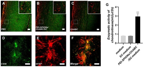 Figure 6 Activity and function assay of ChABC expressed by magnetofected SCs in vitro.Notes: (A–C) After CS56 (green) and GFAP (red) staining, the immunoreactivity in spinal cord sections incubated with conditioned medium from ChABC-magnetofected SC culture (B) and purified ChABC (C) was decreased compared with that observed in cells treated with PBS (A). (D–F) After CS56 (green), GFAP (red) staining and merge file, the immunoreactivity in a slide of astrocytes. (G) The DMB assay demonstrated the enzymatic activity of ChABC in conditioned medium from PEI-SPIONs/ChABC/SC cultures, control cell culture medium or nontransduced SC cultures. Data were presented as the mean±SEM; n=6 per each SC group. ***p<0.005 for comparison with medium group. Scale bar (A–C), 100 μm. Scale bar (D–F), 50 μm.Abbreviations: GFAP, glial fibrillary acidic protein; CS56, monoclonal anti-chondroitin sulfate; PEI-SPIONs, polyethylenimine-coated superparamagnetic iron oxide nanoparticles; ChABC, chondroitinase ABC; SCs, Schwann cells.