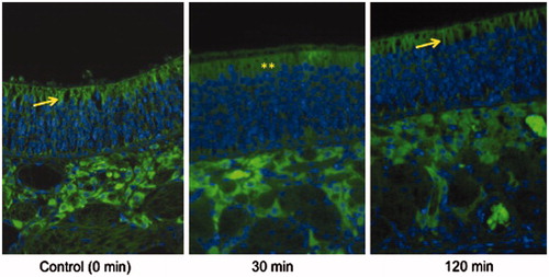 Figure 3. Occludin immunofluorescence: Occludin appears as sharp crisp green bands (yellow arrows) along the edges of the apical surface of OE in control rat (left) and a rat 120 min (right) after IN PV treatment (1.4%). In the rat treated 30 min previously with IN PV (1.4%) (middle), staining is less discrete and diffuse throughout the apical cytoplasm (**) of the olfactory epithelial cells, suggesting that PV treatment reversibly alters localization or conformation of occludin. Sections were photographed at 400×.