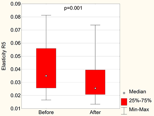 Figure 16 R5 elasticity parameter before and after carboxytherapy.
