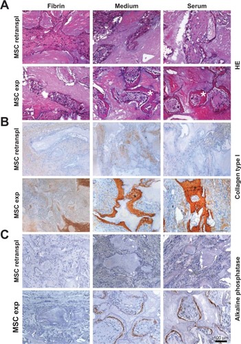 Figure 1 Hematoxylin-eosin (A), collagen type I (B), and alkaline phosphatase (C) immunohistochemical staining in the 4-week group. Bone formation was only seen in the groups with MSC expanded in autologous serum or cell culture medium (*).Abbreviations: exp, expanded; retranspl, retransplanted; HE, hematoxylin-eosin; MSC, mesenchymal stem cells.