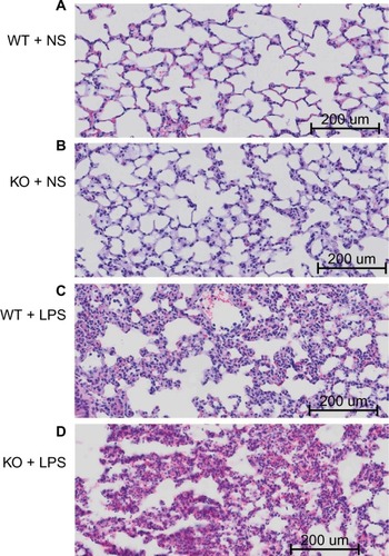 Figure 2 Effect of LPS on lung histology (40×).Notes: Wild-type and CAF1-knockout mice challenged with ns displayed normal lung histology (A) and (B). On the contrary, lungs from wild-type mice stimulated with LPS exhibited features consistent with acute diffuse lung inflammation (C), which included alveolar and interstitial fluid accumulation, thickened alveolar wall, fibrin effusion, the infiltration of lymphocytes and neutrophils, and the destruction of pulmonary alveoli. These changes were more severe in LPS-stimulated CAF1-knockout mice (D).Abbreviations: WT, wild-type mice; KO, CAF1-knockout mice; NS, normal saline; LPS, lipopolysaccharide.