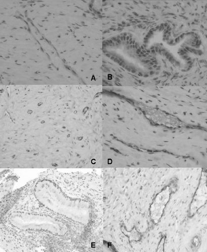 Figure 1 Immunoreactivity of iNOS and eNOS in cervixes of women with early pregnancy. Biopsy samples from mifepristone‐treated (A–D) and control women (E, F). Strong iNOS staining is seen in the endothelium in A (×200) and in the cervical glands in B (×400), but not in the control woman (E, ×200). Endothelial NOS staining is restricted to vascular endothelial cells in mifepristone‐treated (C, ×200; D, ×400) and control women (F, ×200).