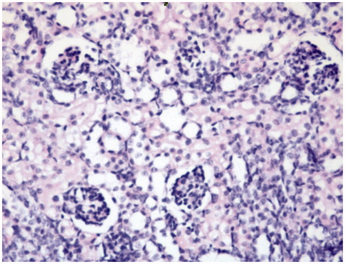 Figure 1. Control: Photomicrograph of the cortex of a kidney from Group 1 (control) showing normal renal histology (HE, 40×).