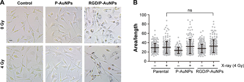 Figure S4 Assessment of morphological changes.Notes: (A) Represent phase-contrast microscopic images of MDA-MB-231 cells treated with or without AuNPs and IR. Bar, 20 μm. (B) Column graph with scatter plot of area/length ratio. More than 150 cells were counted in each sample. Columns, mean, bars, SD.Abbreviations: RGD/P-AuNP, polyethylene-glycolylated gold nanoparticle (P-AuNP) conjugated with Arg–Gly–Asp (RGD) peptides; SD, standard deviation; ns, not significant; IR, ionizing radiation.