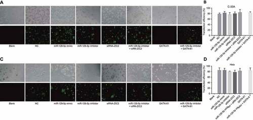 Figure 4. CC cells after 48-h transfection observed under a fluorescence inverted microscope (× 100).Note: A and B, fluorescence images and transfection efficiency of C-33A cell line labeled with FAM; C and D, fluorescence images and transfection efficiency of Hela cell line labeled with FAM; CC, cervical cancer; FAM, carboxy fluorescein.