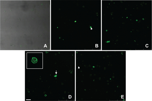Figure S5 Annexin V kit fluorescent staining of HUVECs incubated without or with different IONPs for 6 h. (a) control cells without any particles; (b, d) with citrate-IONP; (d, e) with dextran-IONP; (b, c) cells were incubated with IONPs at iron concentrations of 0.1 nM. cells were incubated with IONPs at iron concentration of 1 nM. Arrows denote possible apoptotic cells. Bar 100 μm.