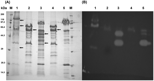 Figure 6. SDS–PAGE and zymography analyses of the chitinase production in the culture supernatant.