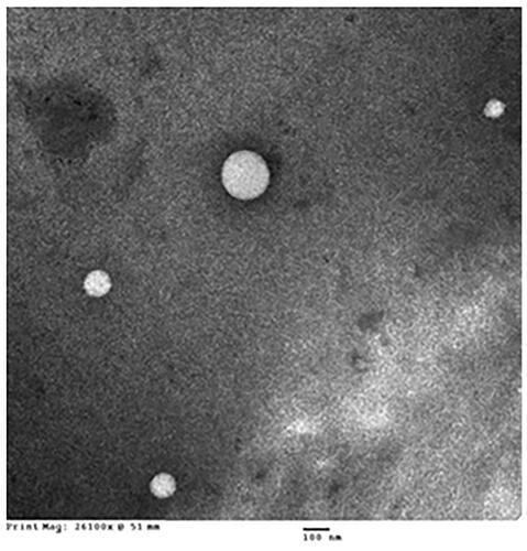 Figure 2. Transmission electron microscope (TEM) images of olmesartan medoxomil self-microemulsifying drug delivery system (OMS) nanoformula.