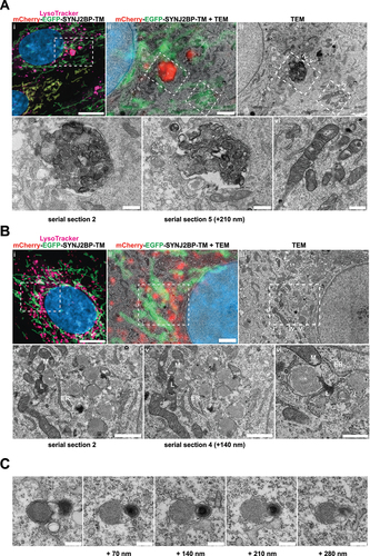 Figure 7. Correlative light and electron microscopy of mCherry-EGFP- SYNJ2BP-TM H9c2 cells reveals the ultrastructure of red-only dots. (A) Red-only dots in cells grown in media containing glucose correspond to autophagic vacuoles with a diverse internal milieu at varying stages of cargo engulfment and maturation (A iv-v). Meanwhile, mitochondria displaying both EGFP and mCherry fluorescence have a normal tubular morphology with distinct inner and outer membranes and intact cristae (A vi). (B) Structures corresponding to red-only dots in galactose adapted cells are more uniform and less electron dense. Imaging of consecutive ultrathin sections (B iv-vi) revealed that these structures are in close proximity (or may be continuous) with membranes of the endoplasmic reticulum (ER) and mitochondria (M). Also note apparent lysosomes (L) at the periphery of red-only structures (*). Scale bars: 10 μm (A i and B i), 2 μm (A ii and B ii), 1 μm (B iv and B v) and 0.5 μm (A iv-vi and B vi). (C) Serial section TEM imaging of a red-only dot shows a single membrane vesicle with apparent remnants of mitochondria and a multilamellar lysosome. Scale bar: 0.3 μm.