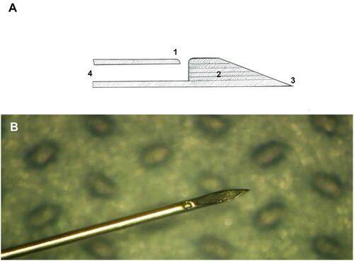 Figure 1 (A) Schematic drawing of the newly designed needle (NDN): 1 – side port with smooth edges for drug delivery; 2 – absence of the dead space; 3 – beveled tip with angle 18º; 4 – caliber 30 gauge. (B) Enlarged view of the NDN prototype. (Created by L. Lytvynchuk.)