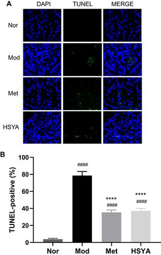 Figure 5 Effect of HSYA on apoptosis of pancreatic β-cells in T2DM rats. Representative images of the TUNEL staining in the four groups. (A) (First column) DAPI staining (blue) indicates total nuclei (middle column) apoptotic nuclei detected by TUNEL staining (green), and (Last column) overlay of both types of staining. (B) The number of TUNEL-positive myocytes was performed as a percentage of total nuclei detected by DAPI staining (fluorescence microscopy, magnification, x60). ####P<0.0001, vs Nor; ****P<0.0001, vs Mod. Results are presented as means ± SD and n=6 in each group.Abbreviations: Nor, Normal group; Mod, Model group; HSYA, hydroxysafflor yellow A.