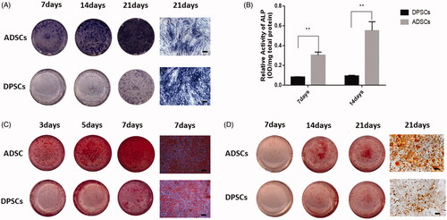 Figure 2. Cell multi-differentiation potential. (A) Alkaline phosphate (ALP) staining at 3, 5, and 7 days after osteogenic induction. (B) ALP activity in the two groups at each time-point determined by ALP semi-quantitatively. (C) Cultures of DPSCs and ADSCs stained with ARS after 7, 14, and 21 days of osteogenic induction. (D) Cultures of DPSCs and ADSCs stained with Oil Red O after 7, 14, and 21 days of adipogenic induction Data are presented as the mean ± standard deviation of the mean (n = 3), **P < .01. Scale bar: 100 µm.