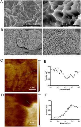 Figure 1 FE-SEM scanning of SLA (A) and Ta-coated implant (B), in which the left part indicated the low magnification and the right part indicated the high magnification. Surface voltage potential mapping of SLA (C) and Ta-coated implant (D) scanned by AFM. The analysis of relative voltage potential (green line in C and D) on SLA (E) and Ta-coated surface (F).