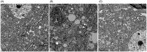 Figure 3. Effects of Shengmai injection (SMI) on the neuron’s morphological changes. Representative electron microphotographs showing neuronal injury in the ischemic penumbra of the cerebral cortex. (A) Mice subjected to the sham operation. (B) Mice subjected to 1h of ischemia and 24 h of reperfusion (tMCAO/R). (C) Mice subjected to 1 h of ischemia and 24h of reperfusion (tMCAO/R). SMI (5.68 g/kg, ip) was administered after 1h of ischemia. Scale bars = 2 μm.