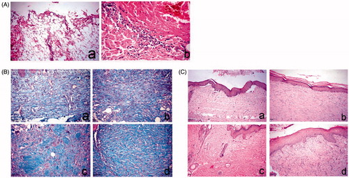 Figure 5. Histopathology of skin wound of dog. (A) At day 0 stained with H&E. a, large wound gap with complete loss of epidermal and dermal cell layer and exposure of the subcutaneous tissue; b, thrombus formation at the margin of the wound intensely infiltrated by polymorph nuclear cells associated with extravagated RBC’s. (B) At day 14, stained with Masson’s trichrome. a, control group showing faint blue stained collagen fibers; b, Panthenol-treated group showing faint blue stained collagen fibers; c and d, Hypericum niosomal gel 1.5% NaCMC-treated group showing intense blue well-organized collagen bundles. (C) At day 21, stained with H&E. a, control group showing closure of the wound gap with attenuated epidermal differentiation; b, Panthenol-treated group showing re-epithelization and keratin formation; c and d, Hypericum niosomal gel 1.5% NaCMC-treated group showing fully re-epithelialized wound with dermal reconstruction, restoration of skin appendages and appearance of hair follicles (arrow) as well as marked contraction of the wound opening.