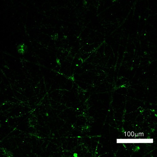 Figure 3 Laser scanning confocal microscopy images of reGFP in co-axial electrospun nanofibers.Abbreviation: reGFP, recombinant enhanced green fluorescent protein.