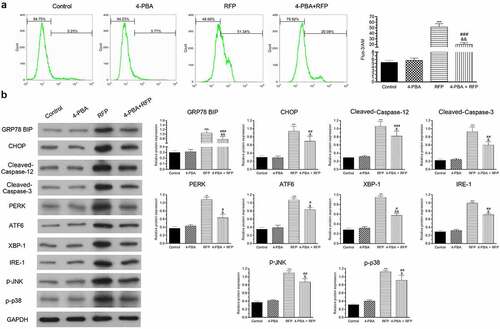 Figure 3. 4-PBA improved RFP-induced intracellular calcium disorder and ER stress response.