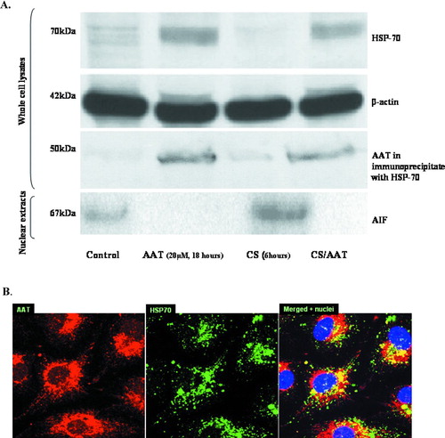 Figure 6 Internalized AAT modulates HSP-70 and AIF. (A) Western Blots of cytoplasmic HSP-70 (top panel), β-actin (second panel), precipitated HSP-70/AAT complexes (third panel) and nuclear AIF (fourth or bottom panel) are shown. Control, AAT-treated (20 μ M, 18 hours), CS-exposed (18 cigarettes/6 hours), and AAT-treated/CS-exposed cells are represented. Protein loading is comparable in all four lines as assessed by uniform β -actin staining (panel below). Co-immunoprecipitation with a specific HSP-70 antibody followed by Western Blot analysis was performed to determine the association of AAT and HSP-70 (the third panel from the top). Finally, AIF detected in the nuclear extracts of PAEC is presented in the bottom panel. Nuclear fractions were loaded by protein concentration (30 ng/well). Representative blots of at least 3 experiments are shown. (B) Confocal microscopic images of AAT-treated (5 μ M, 18 hours) PAEC (1000× magnification) are presented. Binding of primary antibodies to AAT and HSP-70 was visualized using Rhodamine- and FITC-conjugated secondary antibodies for AAT and HSP-70, respectively. Yellow areas within the cells indicate co-localization of proteins. Three identical experiments were performed.