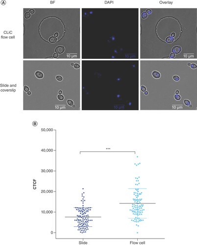 Figure 2. Corrected total cell fluorescence of FM4-64 stained cells under confinement in the convex lens-induced confinement instrument flow cell versus on a traditional microscope slide. (A) Representative images of BY4743 unstained (-) or stained with FM4-64 vacuolar stain (+) and captured under a traditional microscope slide or when confined in the CLiC flow cell. Imaging performed under BF channel and fluorescent channel (Cy3, FM4-64). (B) Box and Whisker plot of corrected total cell fluorescence distribution for n ≥ 300 cells per condition.BF: Brightfield; CLiC: Convex lens-induced confinement; CTCF: Corrected total cell fluorescence; S:N: Signal-to-noise ratio.