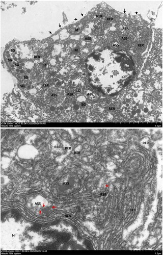 Figure 4. Transmission electron microscopic examination of pancreatic samples. Black solid triangles (▴) indicate cell membrane rupture. Red solid triangles (▴) indicate virus-like particles in the autophagolysosome (ASS). M, mitochondria; N, nucleus; Nu, nucleoli; RER, rough endoplasmic reticulum; SG, secretory granules.