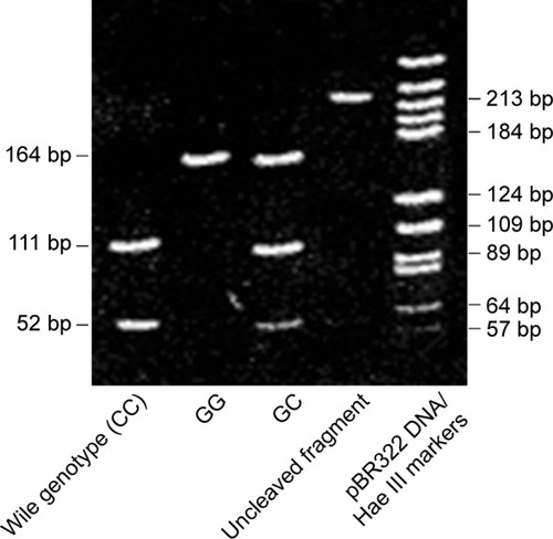 Figure 1 Image of agarose gel fragments of genotypes.