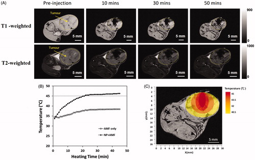 Figure 2. (A) The retention of GdIONPs in the TRAMP-C1 tumour shown by T1 and T2-weighted MR imaging taken at different times. The injected GdIONPs were remained in the TRAMP-C1 tumours (highlighted by the yellow outline) for 10, 30, and 50 min. (B) The temperature distribution profile changes across heating time measured by a thermocouple needle at the GdIONP injection site. The thermotherapy was conducted by an induction heating at an external alternating magnetic field (AMF, 52 kHz and 246 Oe) for 40 min. Mice were injected with PBS (AMF only) or GdIONP (AMF + NP) under external alternating magnetic field (AMF). (C) The simulated temperature distribution within tumour. The tumour temperature decreased by 1.5-°C for every 2 mm away from the TT core.