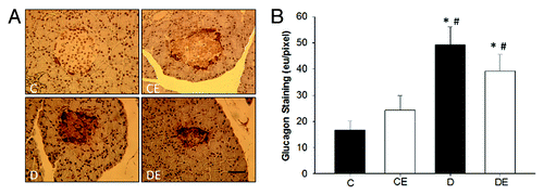 Figure 3. Representative images of pancreatic islet glucagon staining (A) and glucagon quantification (B). Pancreatic islets from both sedentary and exercised rats with T1DM (D and DE) had significantly more glucagon staining than sedentary and exercised non-T1DM (C and CE) rats (P < 0.05). (*) indicates a significant difference from C. (#) indicates a significant difference from CE (P < 0.05). Data are expressed as means ± SE for each animal group. (x40 magnification; Bar = 50 µm)