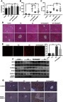 Figure 5 Phosphocreatine attenuated Gynura segetum-induced liver injury in mice. (A) The liver/body weight ratios were calculated for 5 groups (n=6). (B and C) Serum ALT and AST levels were analyzed. (D) Changes in the histopathology of mouse livers by H& E staining. First row, scale bar, 50 μm. Second row, scale bar, 20 μm. (E) Mitochondrial ROS stained with MitoSOX Red in mouse liver tissues were observed by confocal microscope, with the bar chart showing quantification of MitoSOX fluorescence. Scale bar is 100 μm. (F) Representative Western blot bands of SIRT3, Ac-SOD2, SOD2, caspase 3, and cleaved-caspase 3 protein expression in mouse liver. (G) Representative images of liver sections for immunostaining analysis using Ac-SOD2 antibody and cleaved-caspase3 antibody respectively. Scale bar, 100 μm. Values are the mean±SEM. **p<0.01, ***p<0.001.
