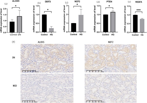 Figure 8. (a) ALOX5, PTEN, DDIT3, and VEGFA mRNA levels in human renal tubular epithelial cells from the control and high-glucose (HG)-treated groups (n = 3 to 5). *p < 0.05, ***p < 0.001. (b) Positive ALOX5 and NCF2 IHC staining was observed in the diabetic neuropathy (DN) group, with negative staining in the minimal change disease (MCD) group. PTEN IHC staining was negative in the DN group, but positive in the MCD group.