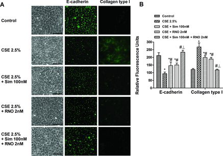 Figure 4.  Effects of roflumilast N-oxide (RNO) and simvastatin (SIM) on cigarette smoke extract (CSE)-induced phenotype alterations in WD-HBECs. (A) WD-HBECs exposed to air exhibit typical cobblestone morphology. Following exposure to CSE (2.5 %) for 72 hours a mesenchymal morphology emerged with reduced cell-cell contact in phase contrast microscopy. These morphological changes were partially prevented by RNO (2 nM) and SIM (100 nM) but abolished by their combination. In line, immunofluorescence analyses revealed reduced E-cadherin but increased collagen type I following CSE (2.5%). RNO (2 nM) and SIM (100 nM) fully prevented these effects while on their own they were partially effective. Representative images are shown. Scale bar: 20 μm. (B) Quantification of immunofluorescence images in relative fluorescence units of n = 3 experiments per condition. Results are expressed as the mean ± SEM. One-way ANOVA followed by post hoc Bonferroni tests. *p < 0.05 related to vehicle controls; #p < 0.05 related to CSE. *# p < 0.05 related to drug monotherapy.