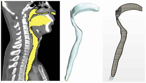 Figure 2. The reconstructed airway geometry in sagittal plane, and final geometry