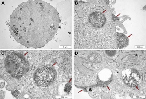 Figure 3 The ultrastructural study of hBM-MSCs labeled with Molday ION.Notes: The low magnification picture of the entire cell (A), the high magnification of part of cells including cell membrane and both uptaken superparamagnetic iron oxide nanoparticles, as well as membrane invagination in the areas of Molday ION accumulation (B and C). Interestingly, the process of internalization of the superparamagnetic iron oxide nanoparticles is also captured (D). The red arrows indicate superparamagnetic iron oxide nanoparticles.Abbreviation: hBM-MSCs, human bone marrow mesenchymal stem cells.