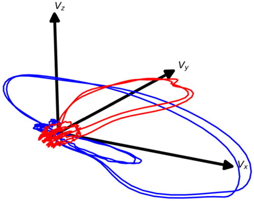 Figure 7. VCG for a healthy control (blue) and myocardial infarction (red).