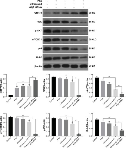 Figure 3 Effect of ultrasound treatment on ERs-mediated PI3K/Akt/mTOR signaling pathway in PTX-resistant PC-3 cells.