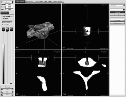 Figure 6. System monitor screenshot showing the 3D reconstruction model and axial, transverse and sagittal tomographic planes.