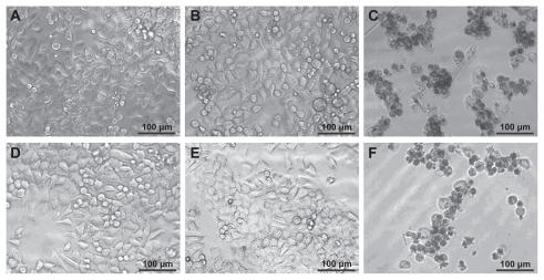 Figure 5 Phase contrast microscopic images of (A) KB cells without treatment and KB cells treated with (B) 1 μL ethanol, (C) free CA4 in 1 μL ethanol (0.5 μM), (D) 10 μL phosphate-buffered saline buffer, (E) G5.NHAc-FI-FA dendrimers in 10 μL phosphate-buffered saline, and (F) G5.NHAc-FI-FA/CA4 complexes with a CA4 concentration of 0.5 μM in 10 μL phosphate-buffered saline, respectively.Abbreviations: G5, generation 5; G5.NHAc-FI-FA, fluorescein isothiocyanate-modified and folic acid-modified G5 PAMAM dendrimers with acetyl terminal groups; CA4, combretastatin A4.