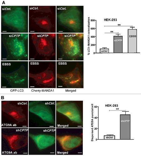 Figure 4. Golgi fragments induced by CPTP depletion partially localize with LC3. (A) HEK-293 cells grown in complete medium, were cotransfected with a plasmid encoding GFP-LC3 and mCherry-MAN2A1 (medial Golgi marker) and then treated with scrambled-siCPTP (control), siCPTP, or subjected to serum starvation (EBSS, 2 h). The green channel shows LC3-II puncta, the red channel shows the medial-Golgi stacks visualized with mCherry-MAN2A1, and the merged yellow channel shows colocalized LC3-II and Golgi fragments. In the adjacent bar graph, the colocalization percentage for LC3 and MAN2A1 in the siCPTP- or EBSS-treated cells is normalized to siCtrl-treated cells. Bars: 10 µm. (B) HEK-293 cells, treated with either scrambled-shCPTP and GFP-vector (shCtrl.) or shCPTP and GFP-vector, were immunolabeled with primary antibody (ab) to ATG9A followed by Alexa Fluor 595 secondary antibody. In CPTP-depleted cells, the red channel shows cytoplasmically dispersed ATG9A, which otherwise localizes mostly to the perinuclear space in shCtrl-treated cells. Quantification in the adjacent bar graph involved image analyses of 20 cells per group from 3 independent experiments. Values are means ± s.e.m of 3 independent experiments carried out in triplicate. *P < 0.05, **P < 0.01, ***P < 0.001 Student t test compared to controls.