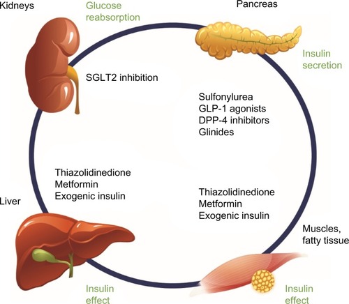 Figure 1 Pharmacologic options for the treatment of T2DM: SGLT2 inhibition in the kidneys complements existing treatment options through an insulin-independent mechanism of action.